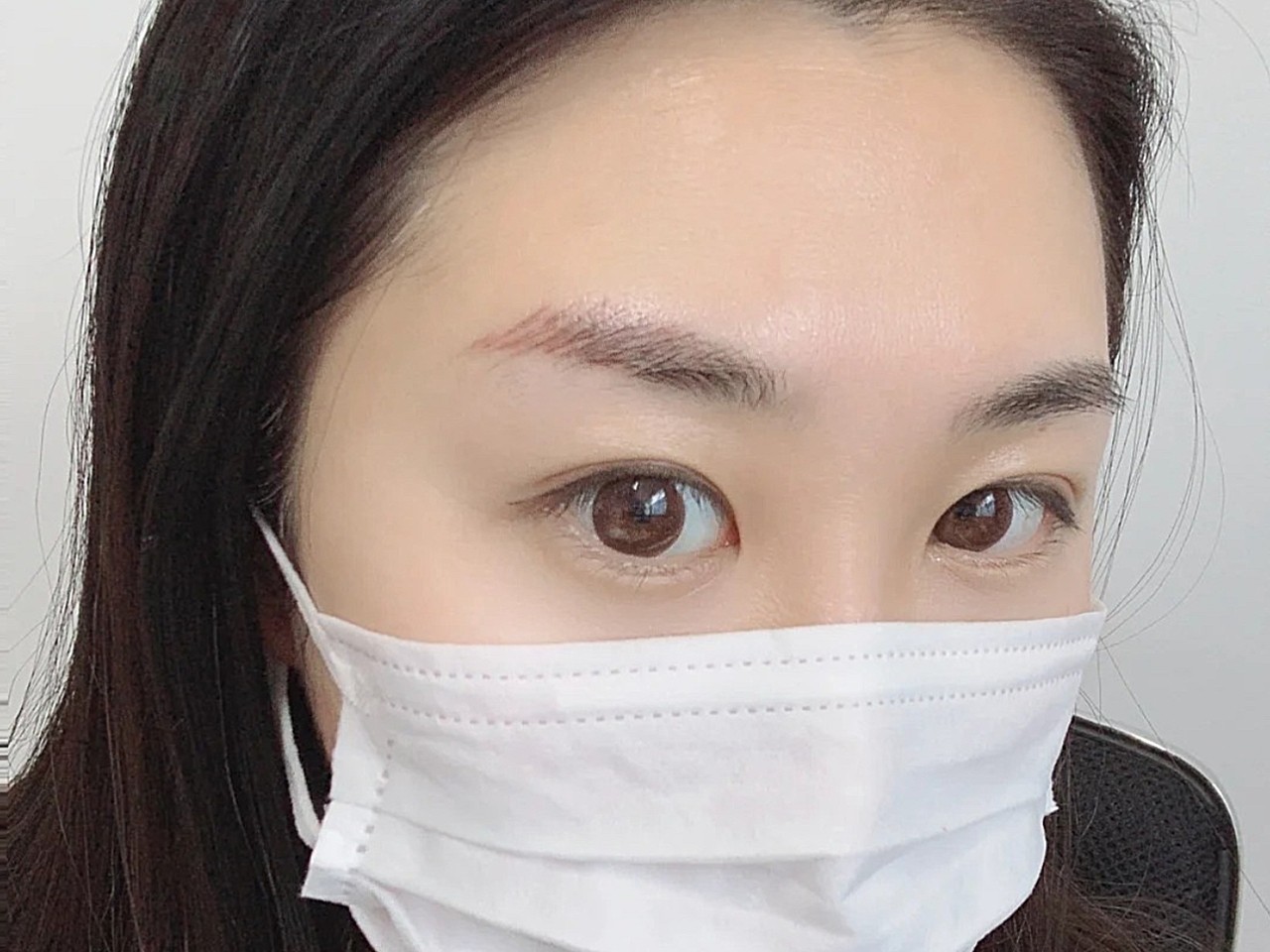 洗了有几天了,效果不错,眉尾红色是印记已经看不太清_圈子-新氧美容