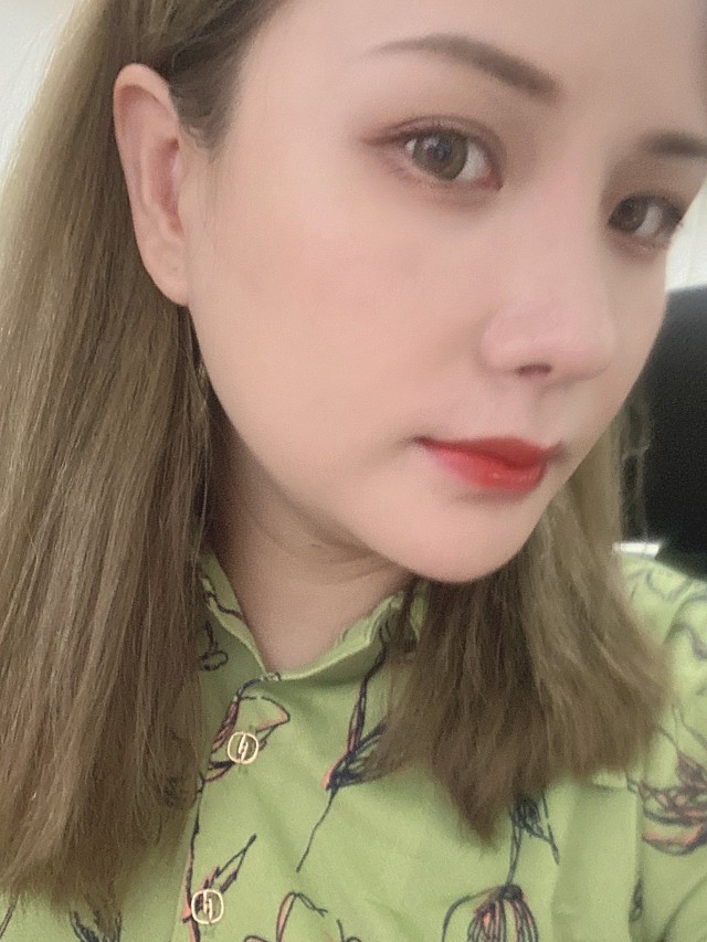 嘴巴现在恢复也是很自然啦,嘴角自然上翘的弧度和唇的_圈子-新氧美容