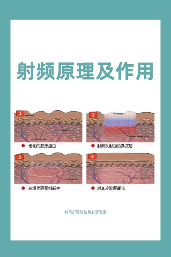 在医美界,光电美肤项目是很重要的一大版块,细分起来_圈子-新氧美容