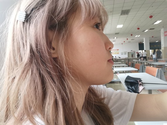 感觉我侧脸肉多_圈子-新氧美容整形