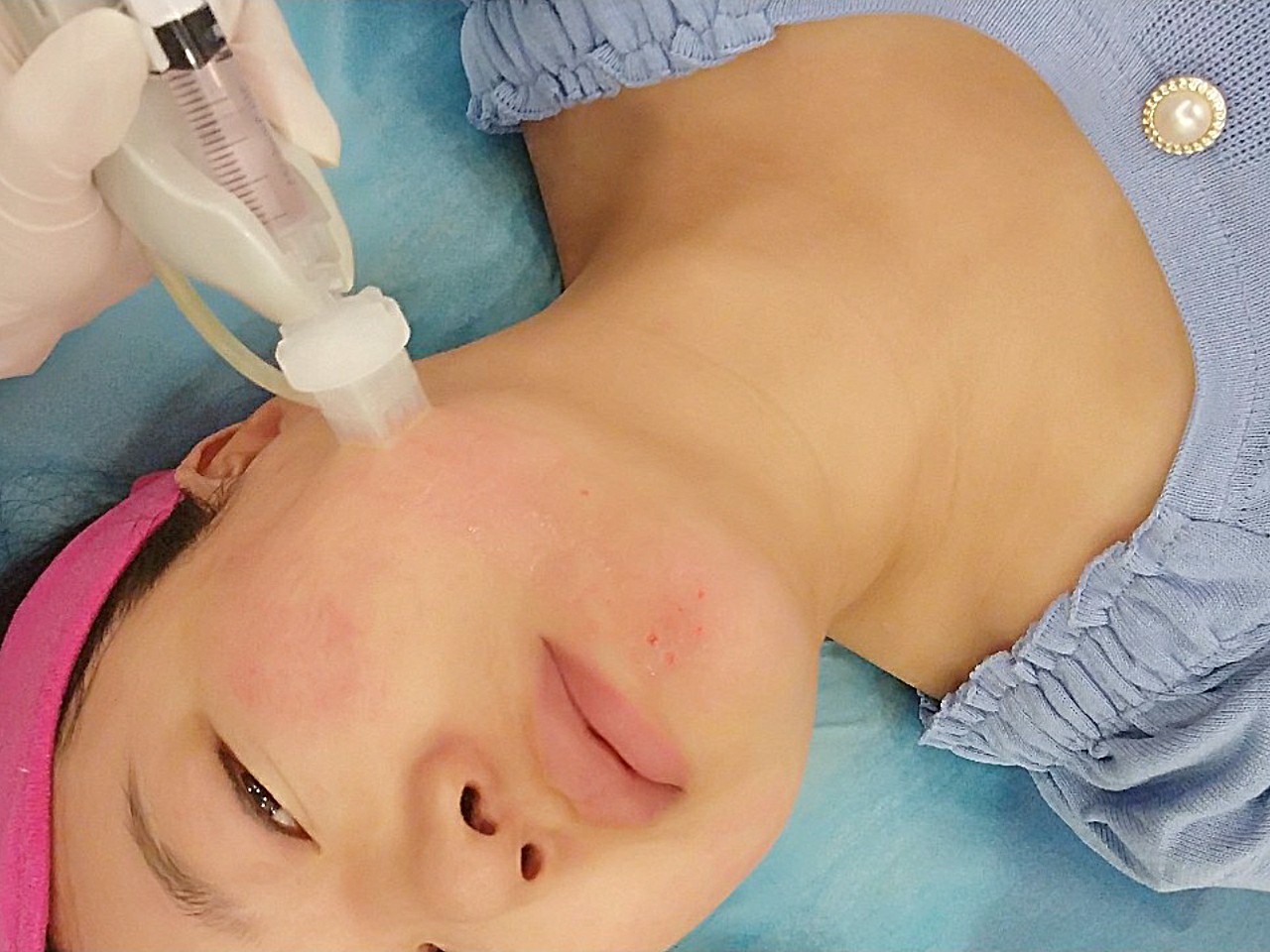 上次打水光补水已经是两个月之前,打了之后还去海南和北京玩了一个月