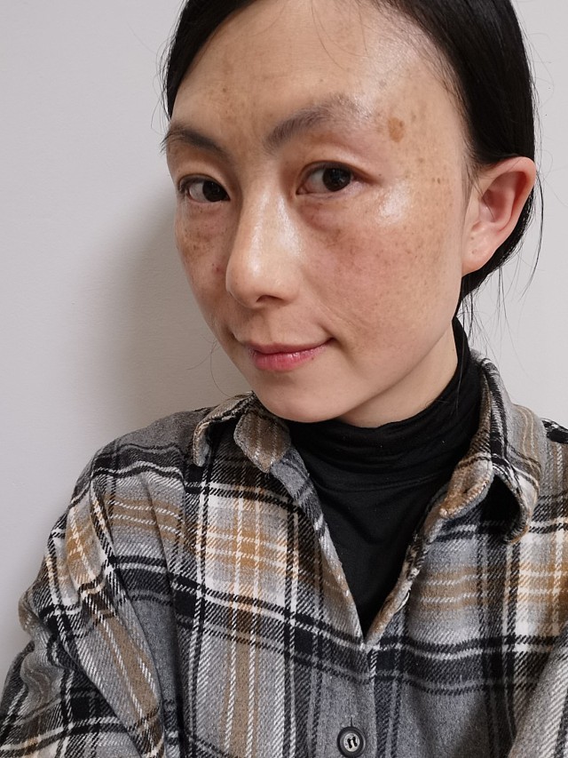 都说女生要自信才是最美的,但是我再自信都没办法忽视我脸上的斑以前