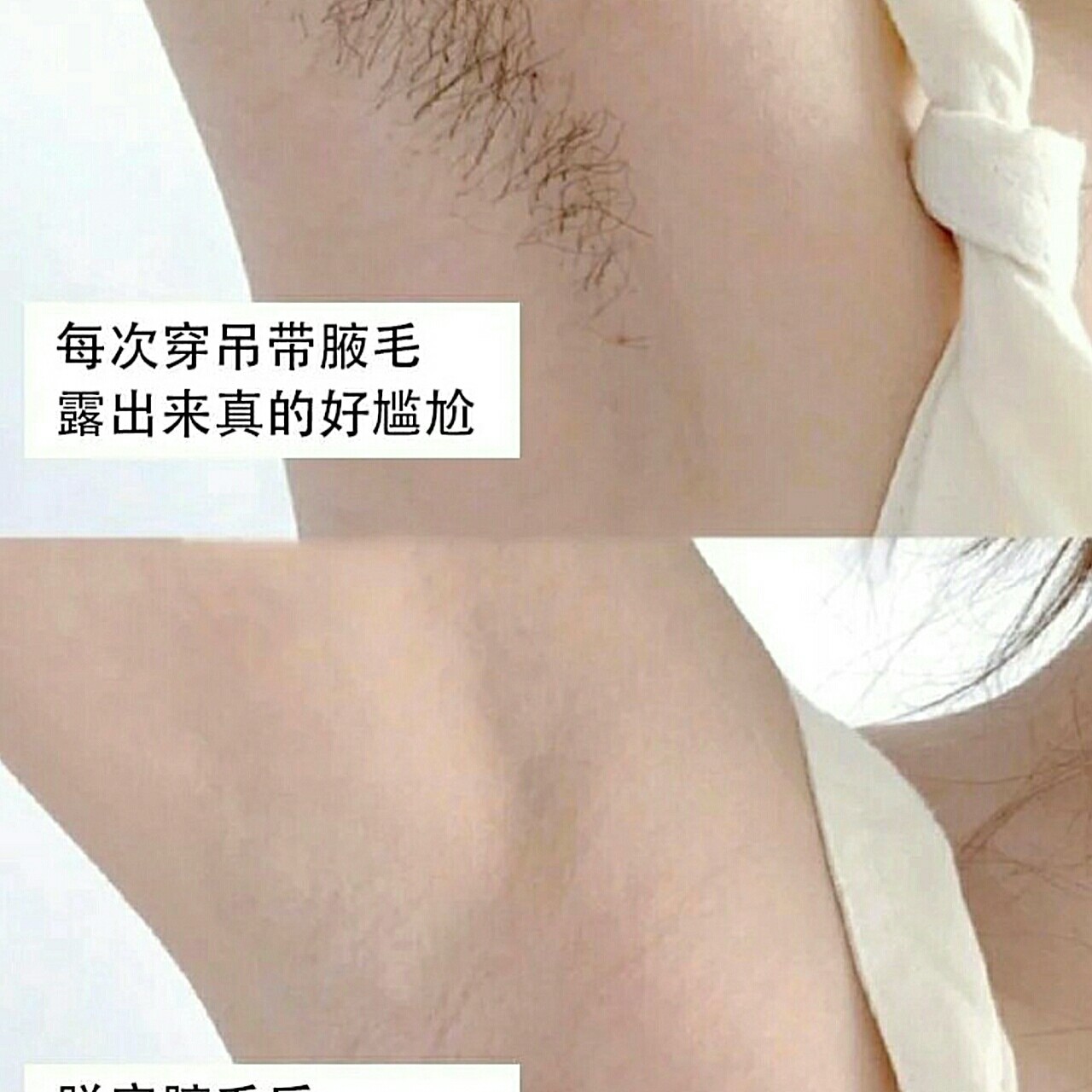 体验前变美诉求脱腋毛