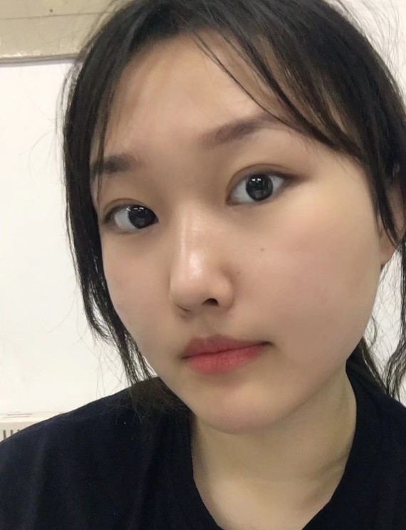 评论 表情 图片  提 交  相关评论 6月23日 0 holly0 主要是鼻翼窄