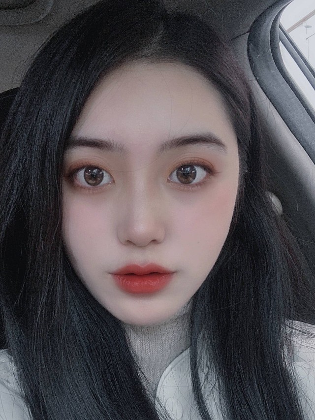 [:161]个人感受:我属于大宽下巴,之前不知道原_圈子-新氧美容整形