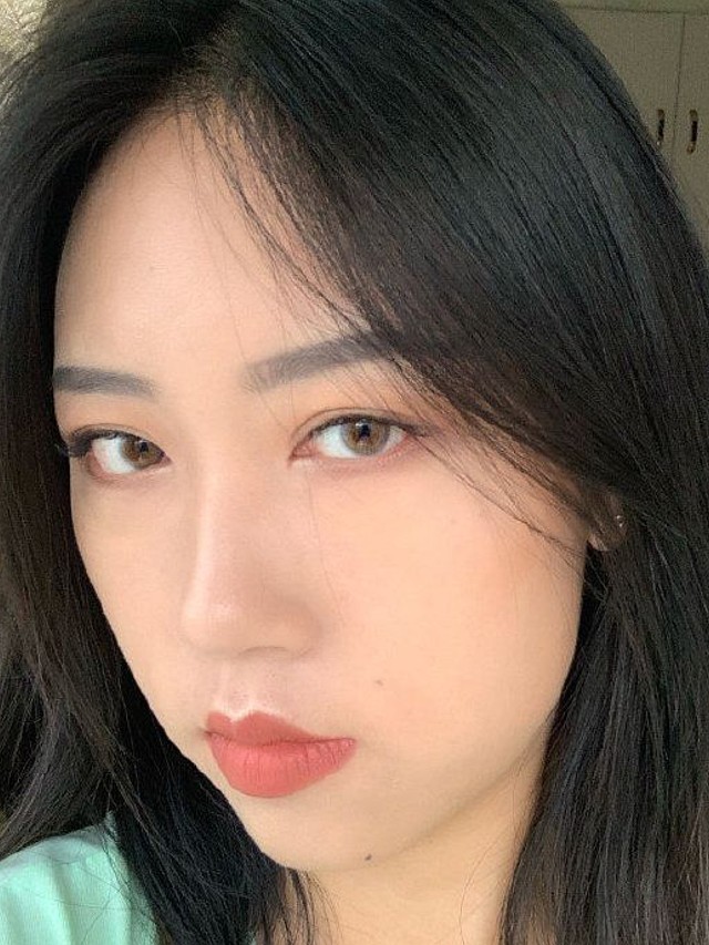 我的眼睛是小且上扬的,面诊时和刘主任沟通了很多,基_圈子-新氧美容