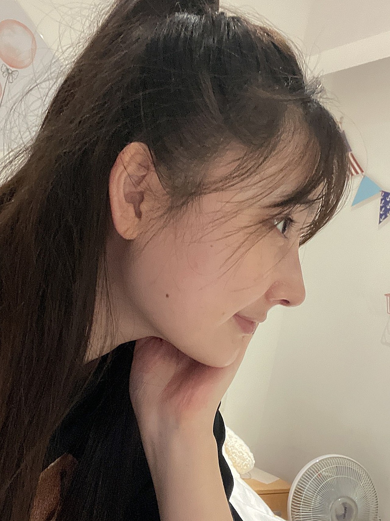 求美者鼻部术前没有形态山根较低鼻头圆润显得老气俗称的大鼻头鼻骨宽