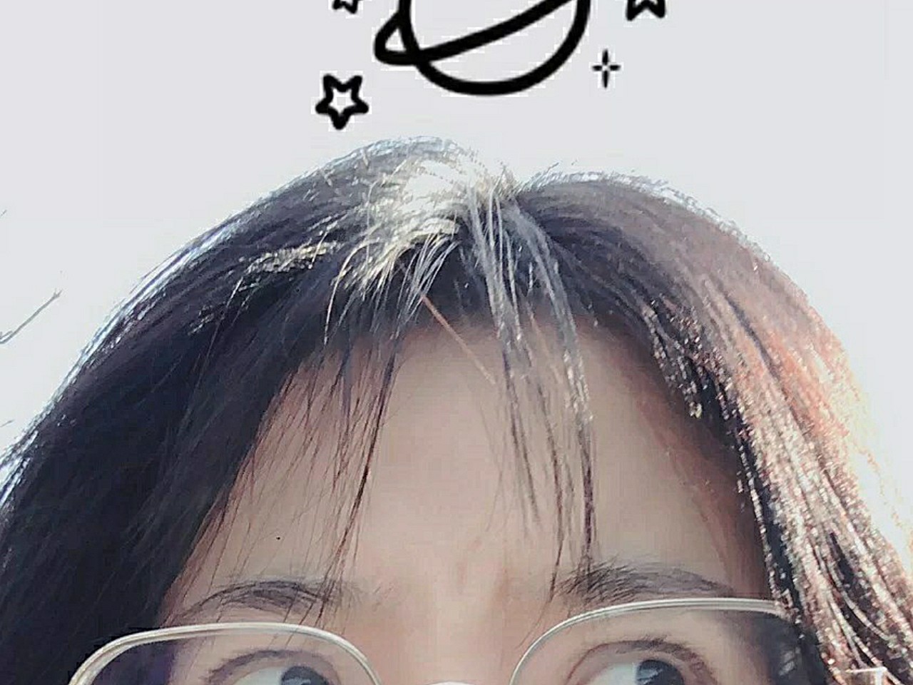 我从小就是大内双鱼泡眼而且高度近视眼球突出,所以笑起来和个核桃一