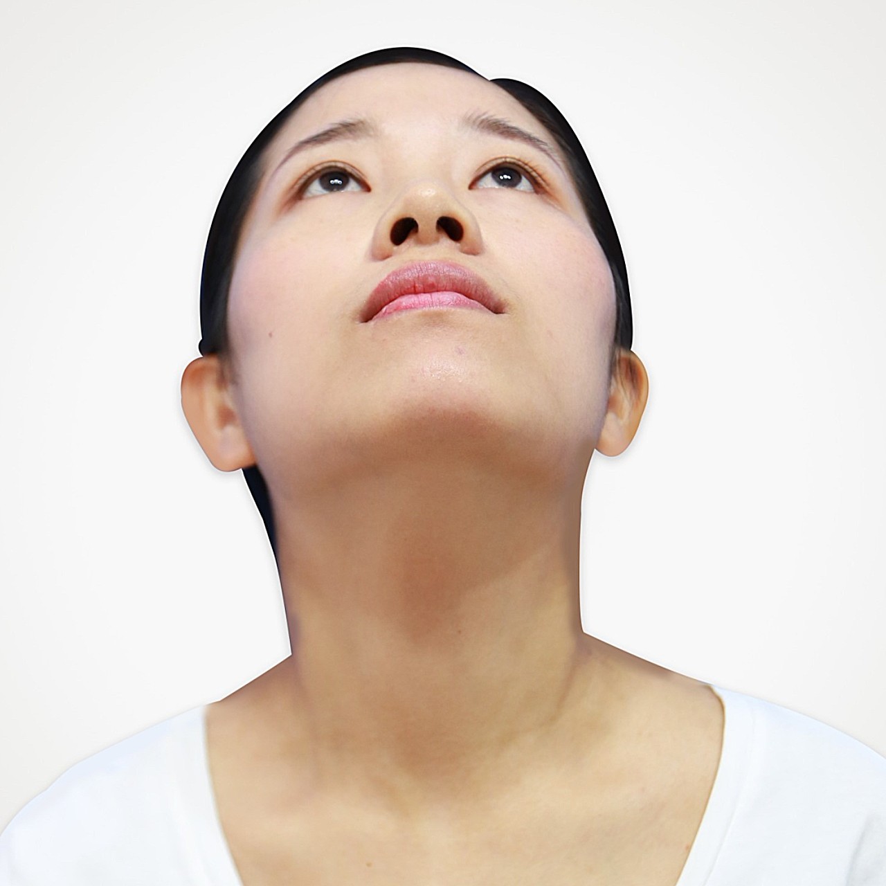 术前诊断术前患者山根低平,鼻梁没有弧度,有点塌陷