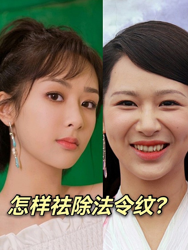 讨论|法令纹好显老!怎样才能有效祛除?