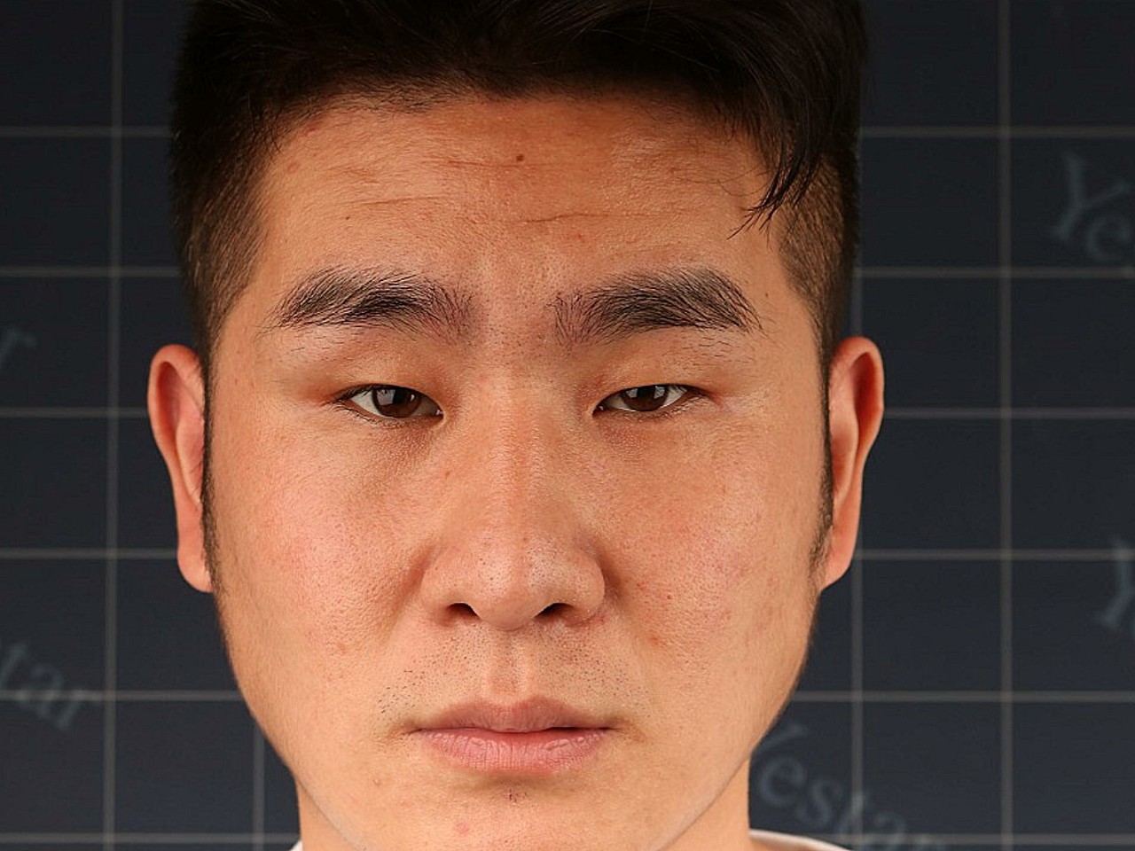 术前诊断豆豆眼怎么解决?