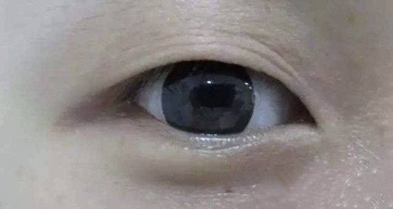 造成这样的习惯性挑眉原因,一般是有两种.