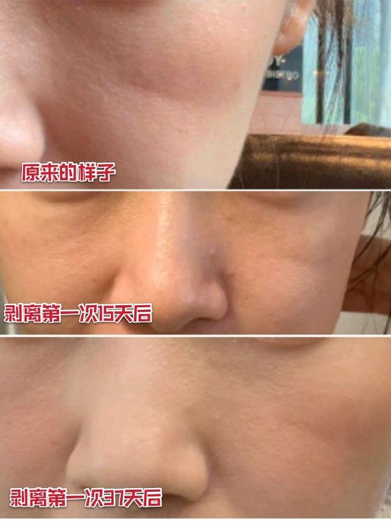 纯分享印第安纹剥离效果73