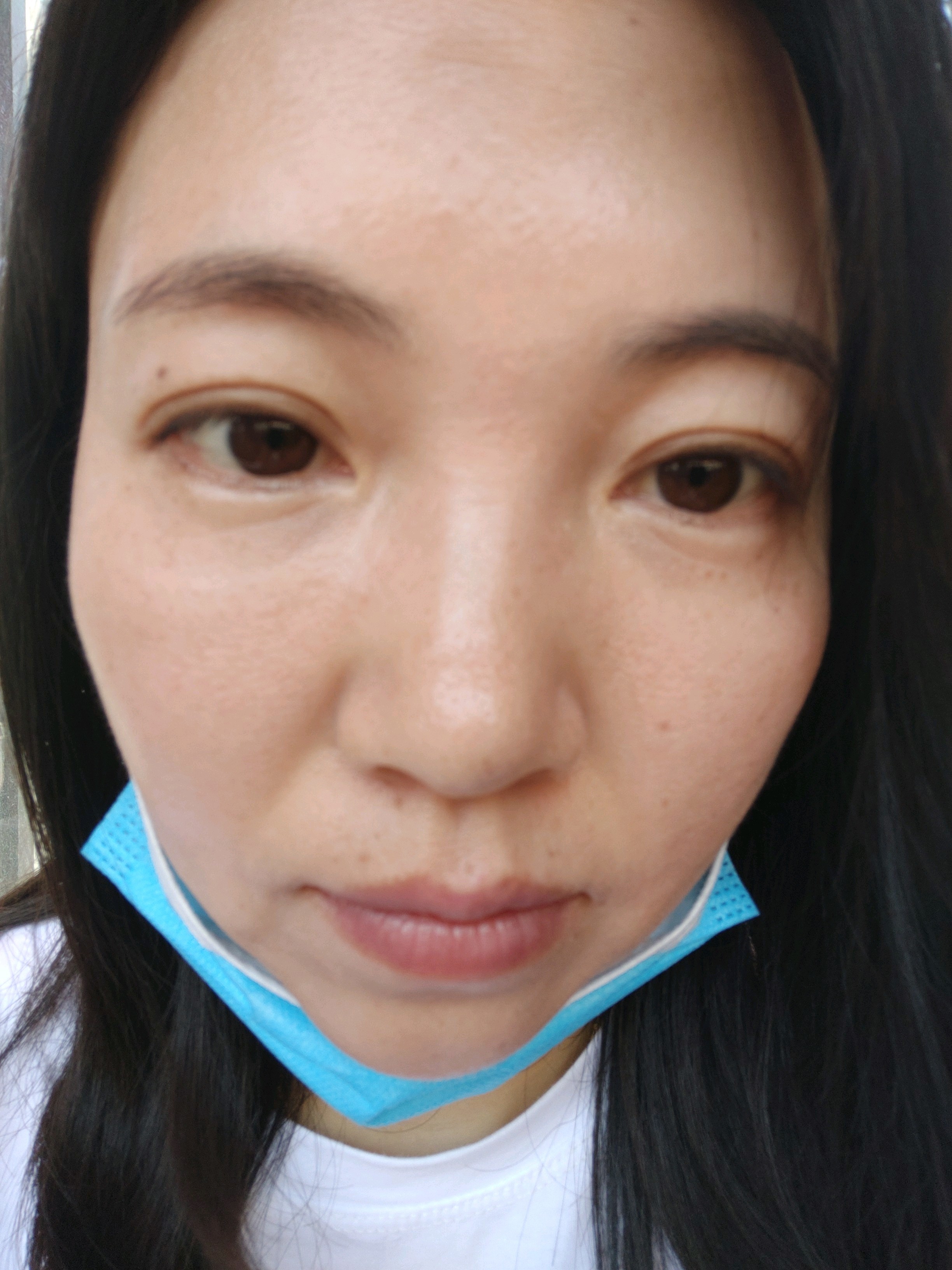 祛黑眼圈应该还行眼纹没效果没效果