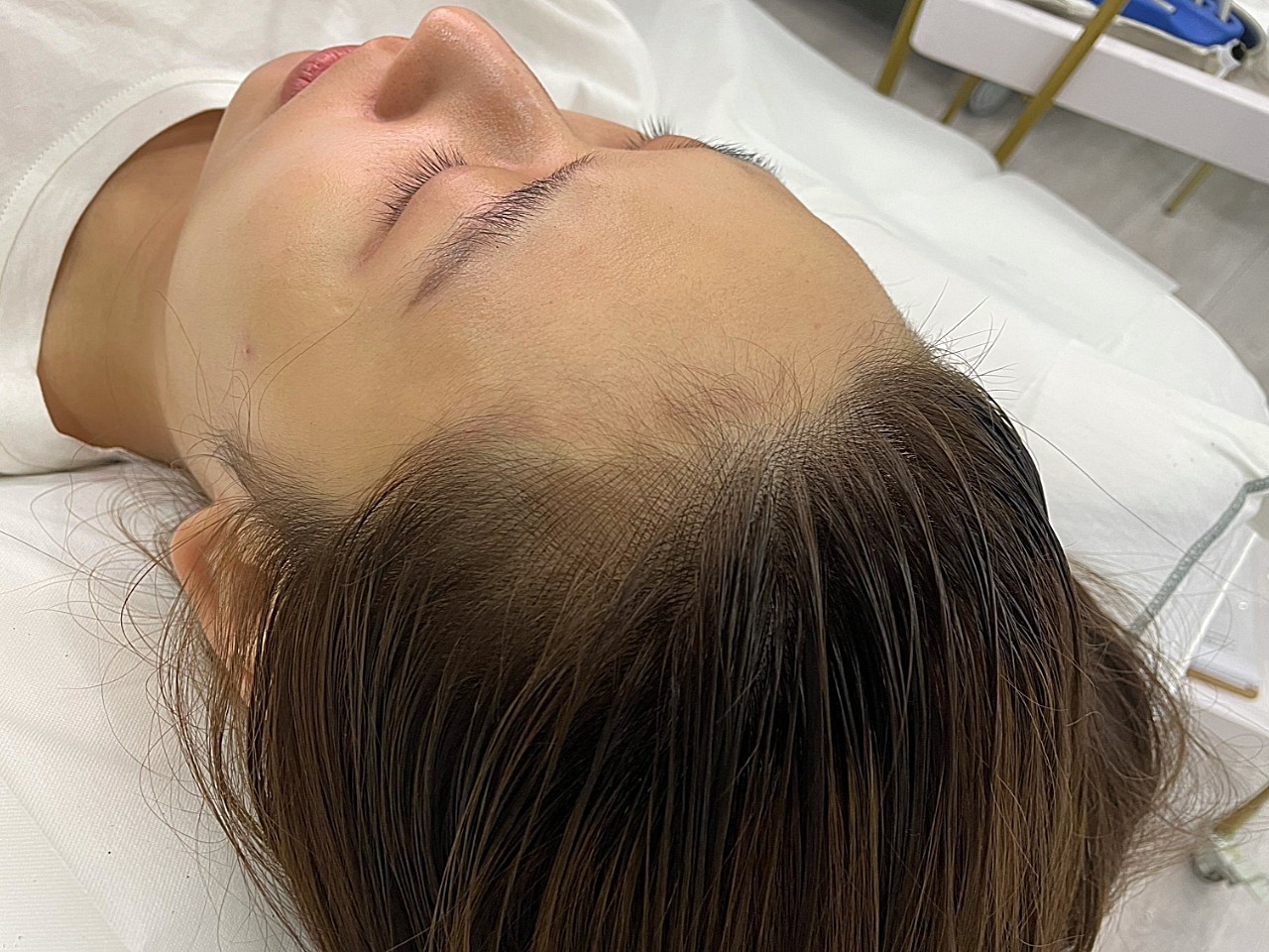 最近才发现了半永久发际线这个新大陆,以前只听说过眉_圈子-新氧美容