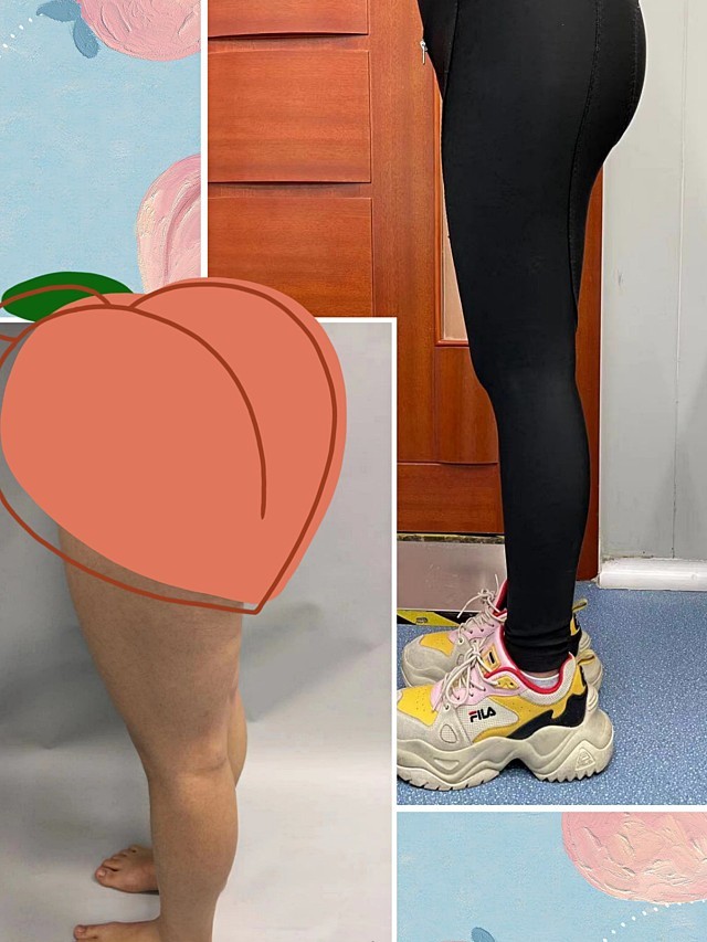 梨形身材我是小腿超细屁股大腿粗100斤看着像120_圈子-新氧美容整形