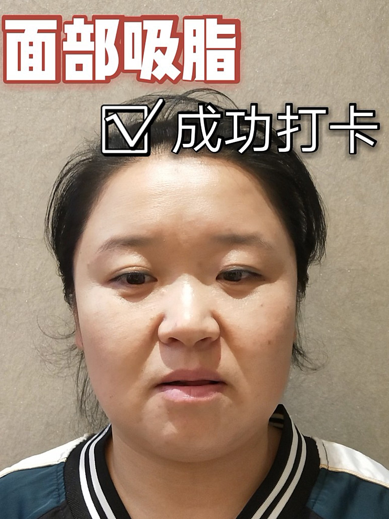 关于脸部整形美容案例分享范文的信息《关于脸部整形美容案例分享范文的信息怎么写》