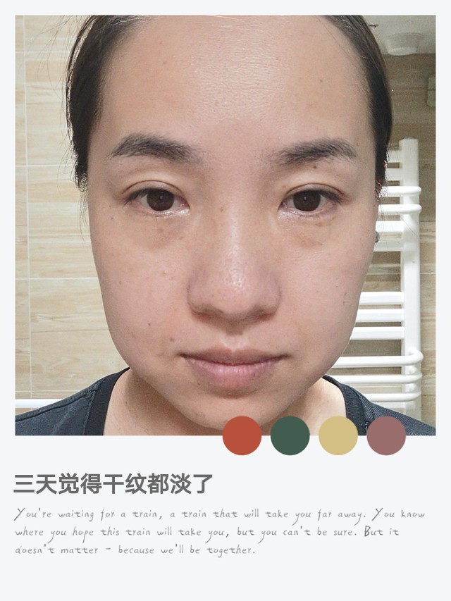 艾瑞巴蒂,集美们,夏天过得怎么样?