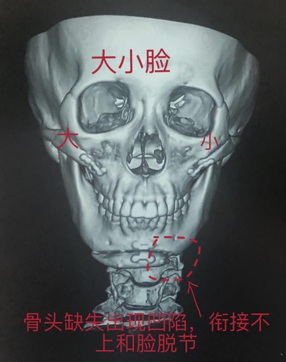 公立医院真的比_圈子-新氧美容整形