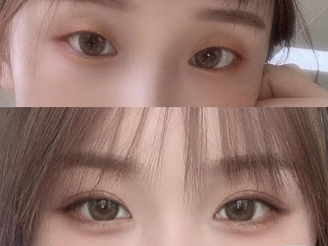 [:163]体验前变美诉求:纯单眼皮,眼皮薄,想让_圈子-新氧美容整形