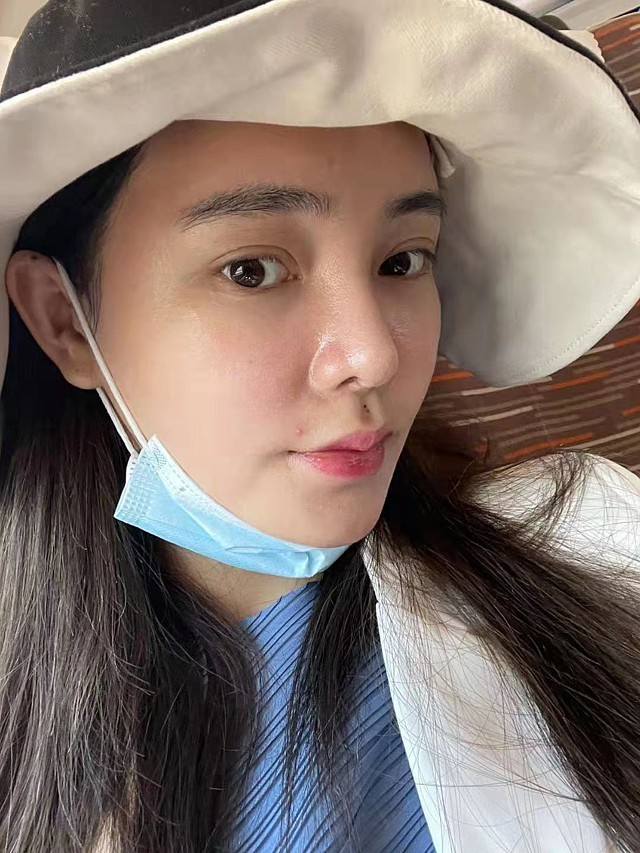 我的人中虽然有点形状,但人中沟就很浅很平,没有美感_圈子-新氧美容