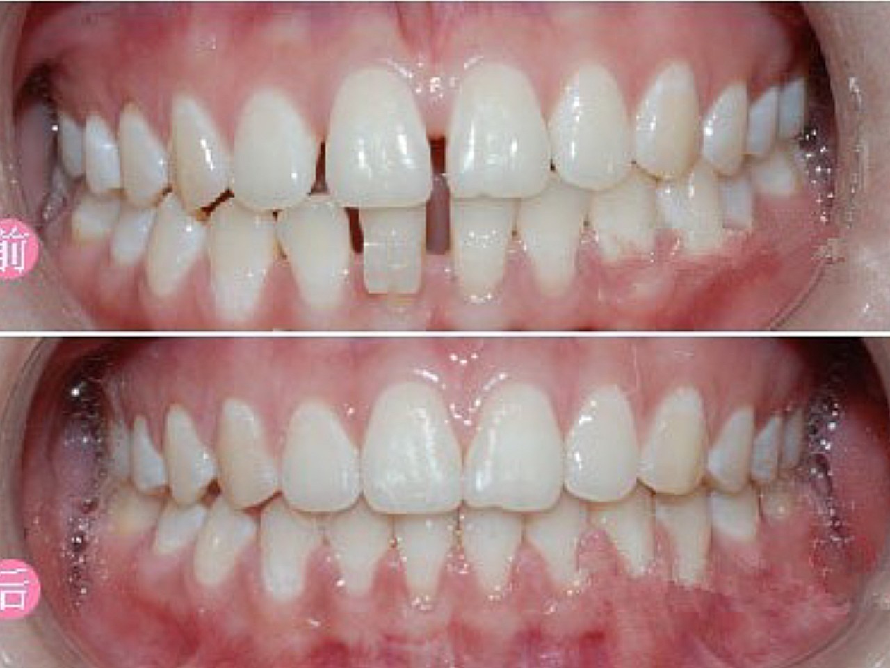 牙齿矫正做的很好对比了几家选择的性价比也不错