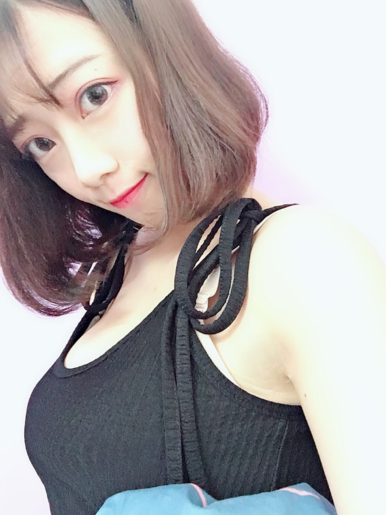 这位求美者属于典型的青春期乳房发育不良,导致胸部较扁平.