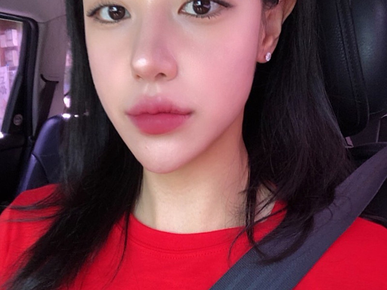 半侧脸做完后医生让我轻轻用手掂量两侧的面部软组织的_圈子-新氧美容