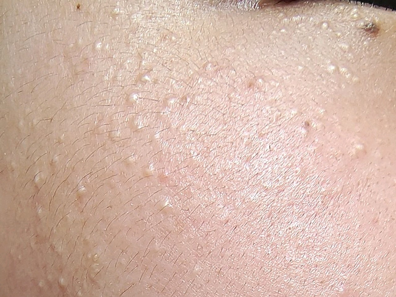 那位大佬能说一下这白点点是什么07