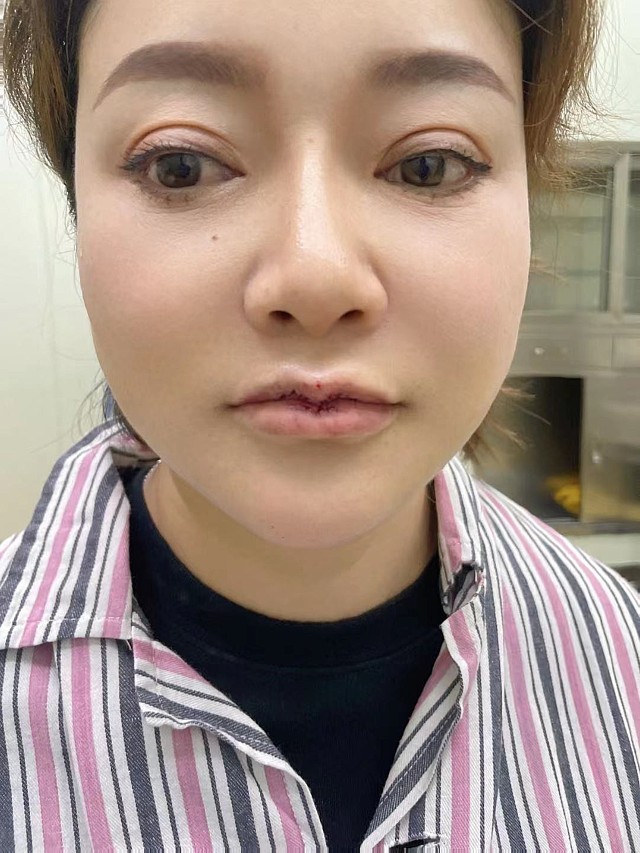 嘴型不好看真的很影响颜值_圈子-新氧美容整形