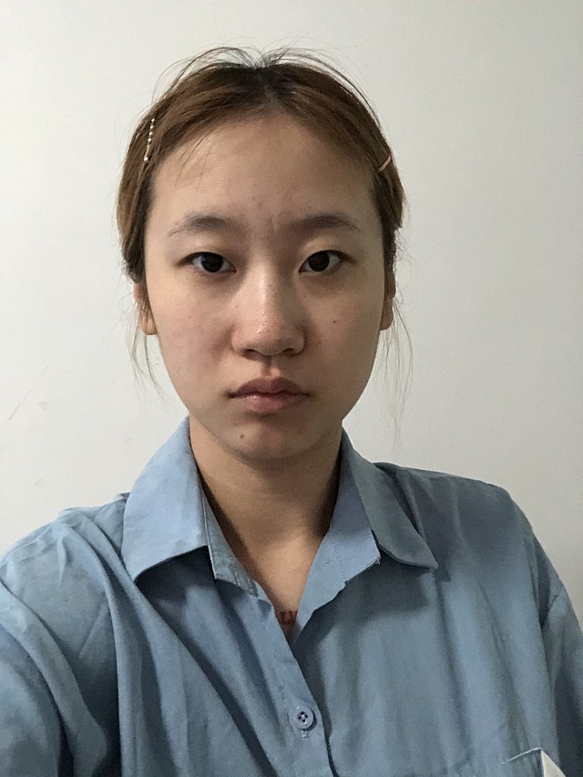 终于下定决心来做鼻子了,我一直觉得自己的鼻子不好看,一点鼻梁没有
