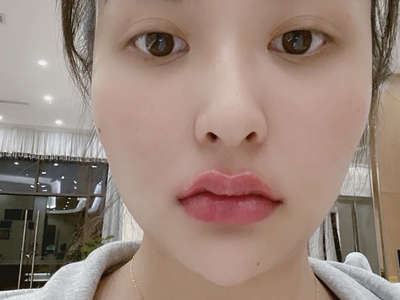 体验前变美诉求:最近很流行那种肉欲唇,考虑了好久,也对比了很多家