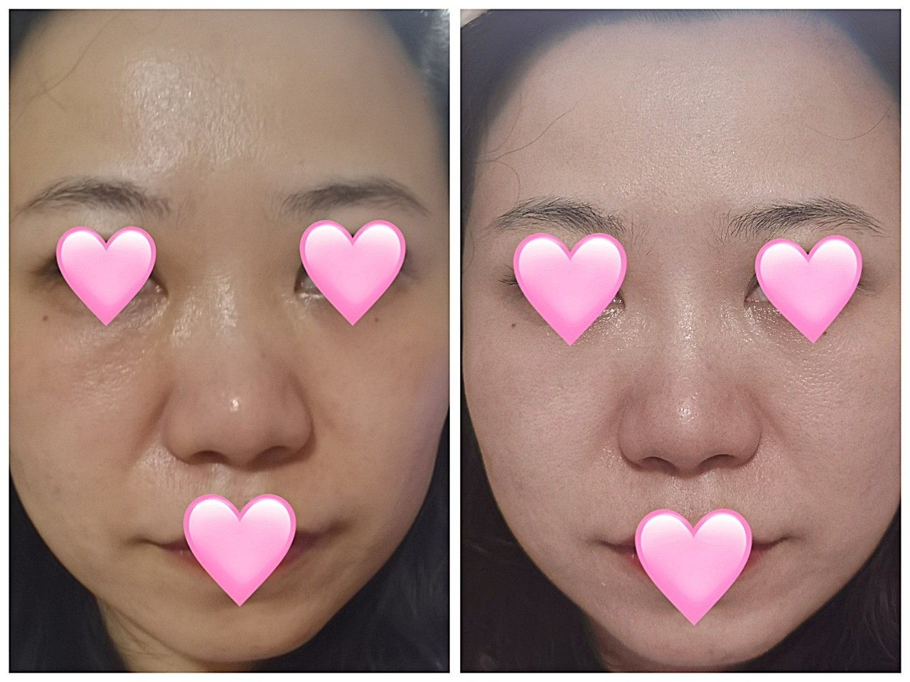 体验前变美诉求:我的皮肤是大油田,而且很容易发黄,发黑,用过很多美白