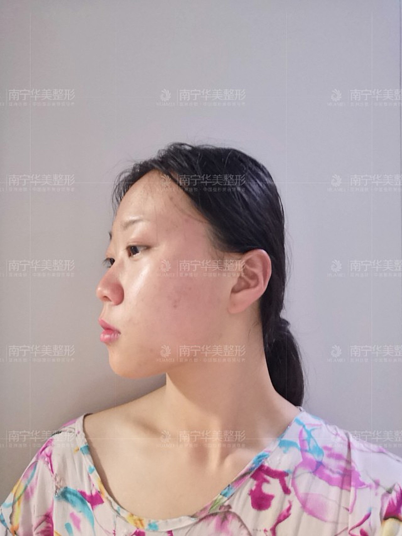 但是唯独缺少了一个漂亮的鼻子