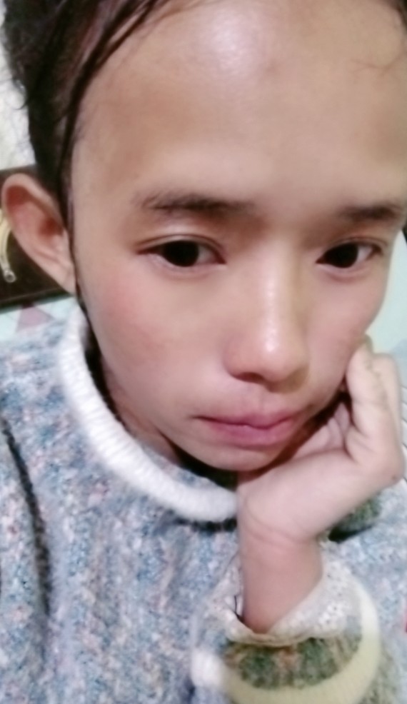 很自卑,感觉自己长的丑