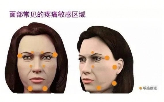 面部常见的疼痛敏感区域有:眉弓骨,眉心,四白穴附近,耳屏处,下巴两侧