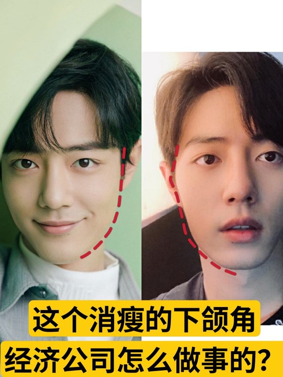 16615发际线变高了,也许是发型的原因这次肖战的发际线看起来格外