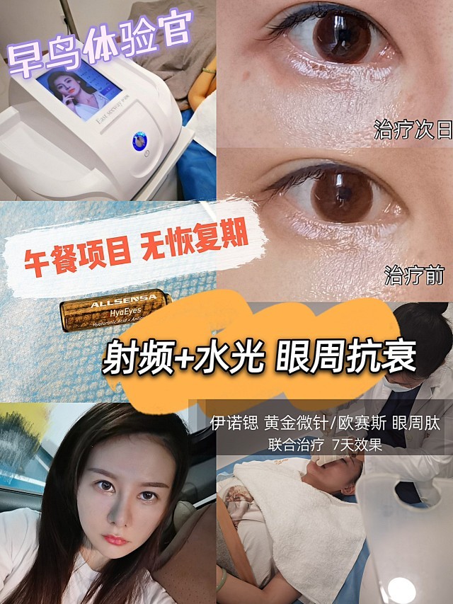 早鸟体验官午餐项目无恢复期射频77水光眼周抗衰伊诺_圈子-新氧