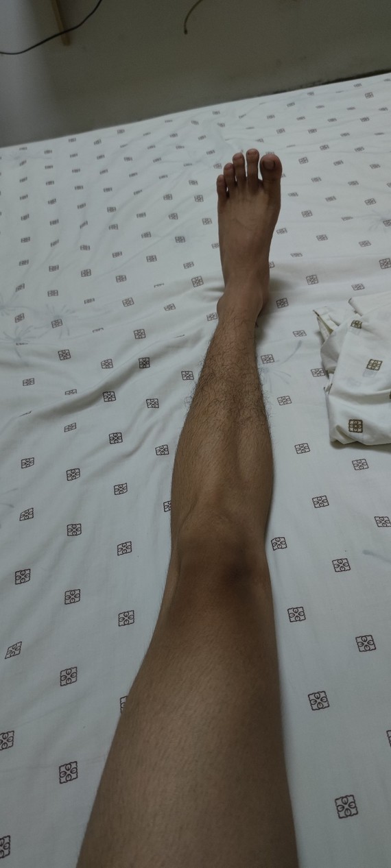 男生腿型照片图片