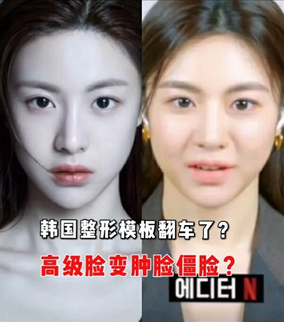 韩国新一代整容模板翻车?史诗级诈骗?