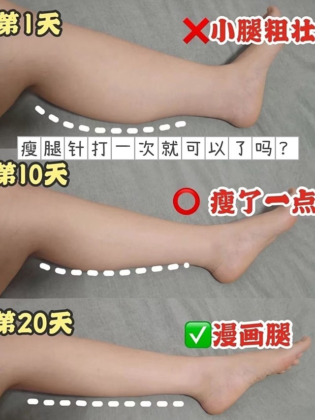 瘦腿针打一次就可以了吗?