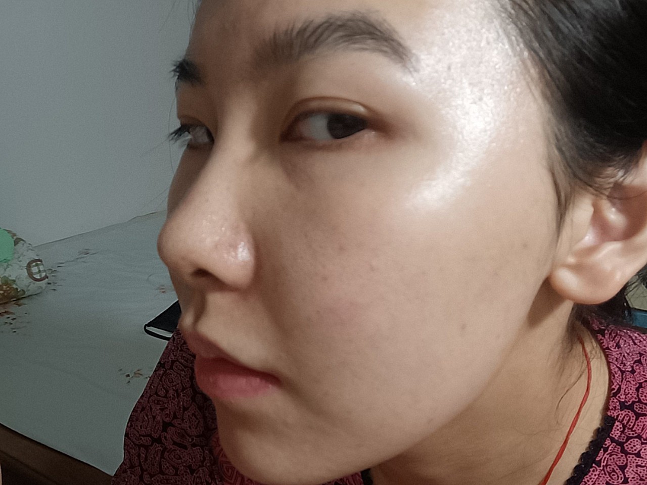 我的皮肤比较薄而且脆弱 加上之前经常出门晒