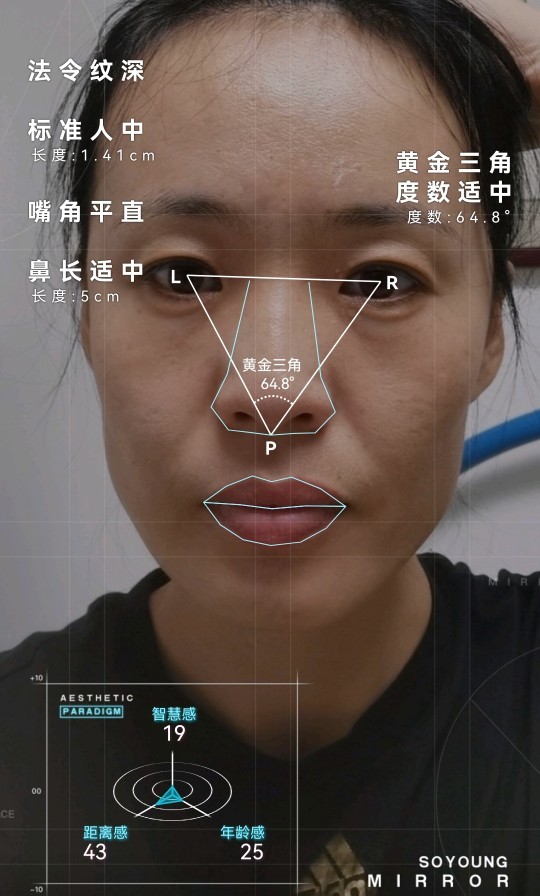 黄金三角度数适中,中下庭比和五眼比例也均衡五官没有大问题