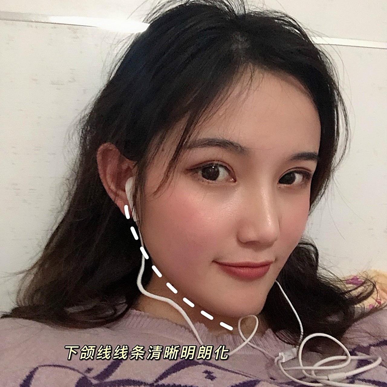 下颌线是面部轮廓线中非常重要的一条美学线,跟骨骼发_圈子-新氧美容