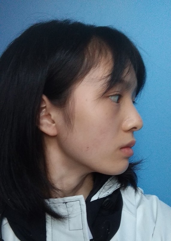 像,说是明星脸不为过90素颜正面照,非要挑出点问题,就是颅顶有点低