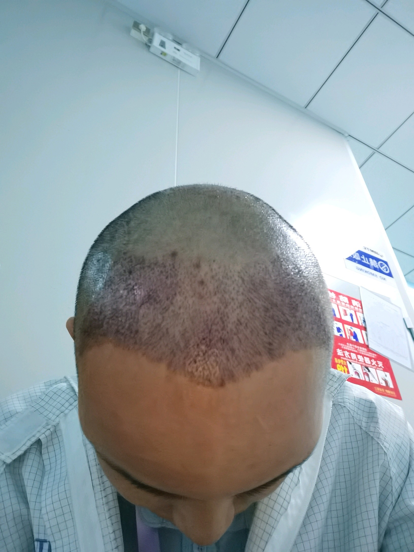 头肿了脸也肿了停不自在的