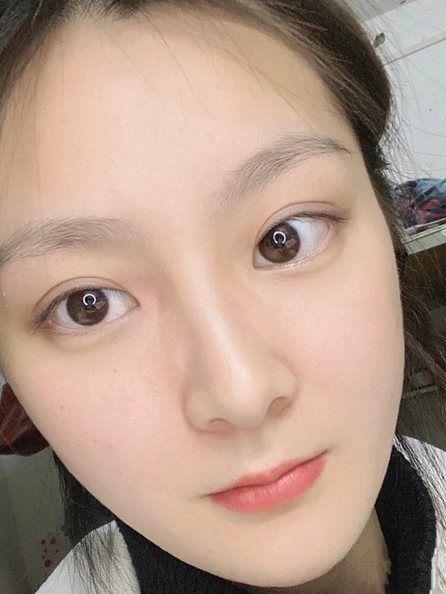 [:163]体验前变美诉求:眼睛有点丹凤眼狭长不好_圈子-新氧美容整形