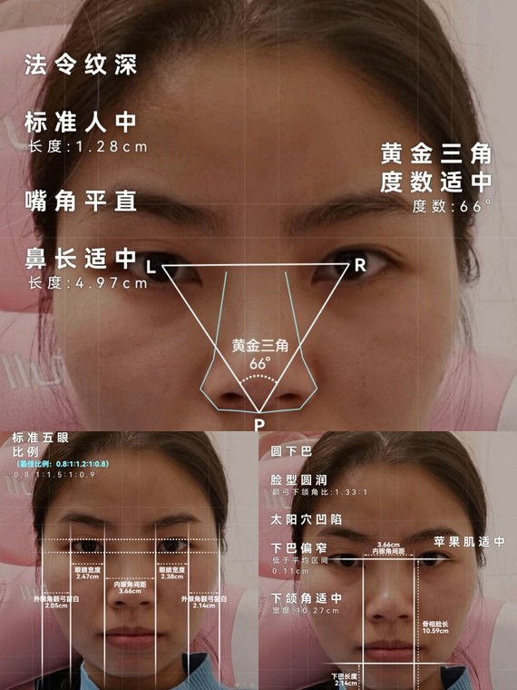 00先来看一下小可爱的面部底层美学结构情况,小可爱的黄金三角度数