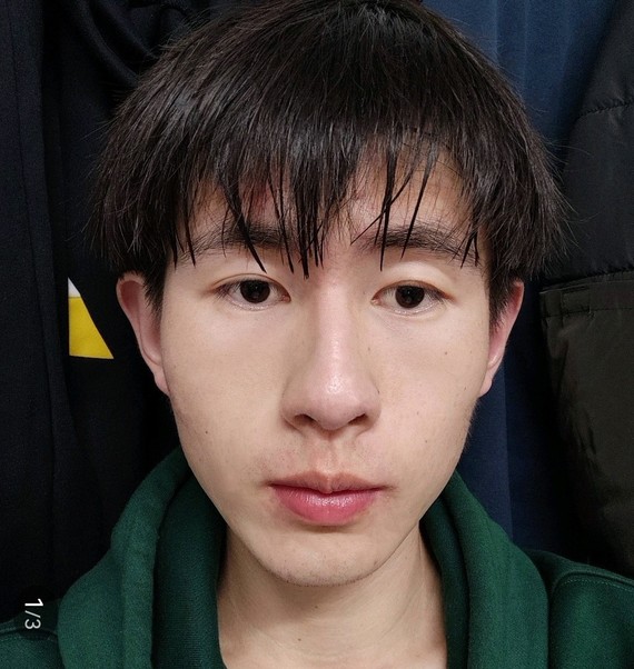 面部骨骼分明,颧骨外凸太阳穴凹陷,但是面中又显得有轻微扁平甚至凹陷