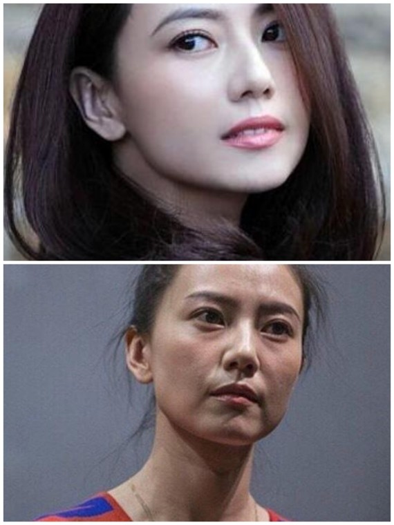 如果你开始出现法令纹,木偶纹,嘴角下垂,面颊凹陷,唇部干瘪,唇纹,唇